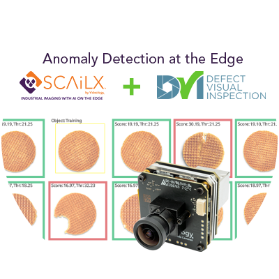 SCAiLX anomaly detection